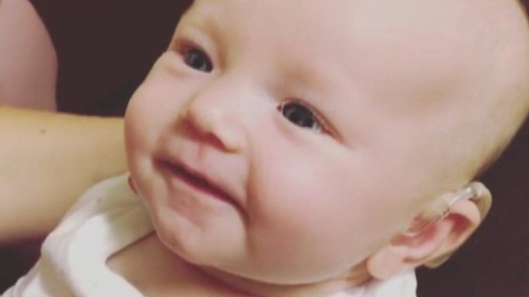 AMAZING! This baby can hear her mom for the first time